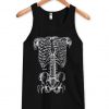 X-Ray tanktop